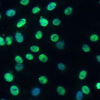 Anti-TIF1 beta Antibody