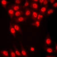 Anti-Histone H3 (TriMethyl-K4) Antibody