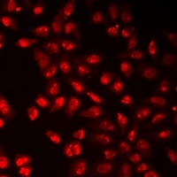 Anti-Histone H3 (TriMethyl-K9) Antibody
