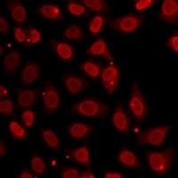 Anti-Histone H3 (TriMethyl-K27) Antibody