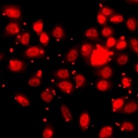 Anti-Histone H3 (TriMethyl-K27) Antibody