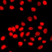 Anti-Histone H3 (TriMethyl-K27) Antibody