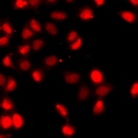 Anti-Histone H3 (DiMethyl-K79) Antibody
