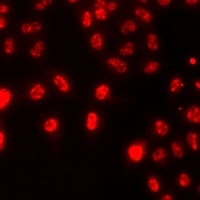 Anti-Histone H3 (DiMethyl-K79) Antibody