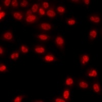 Anti-Histone H3 (DiMethyl-K79) Antibody