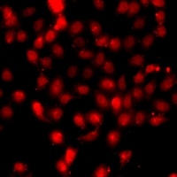 Anti-Histone H3 (DiMethyl-K79) Antibody