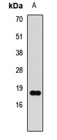 Histone H3 (DiMethyl-K79) Antibody