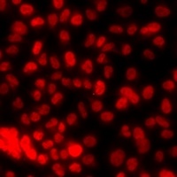 Anti-Histone H3 (DiMethyl-K79) Antibody