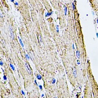 Anti-Filamin B Antibody