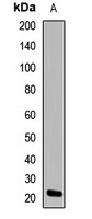 Alpha-crystallin C Rabbit Polyclonal Antibody