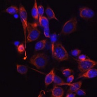 Anti-DKK3 Antibody