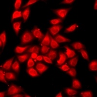 Anti-OAS1 Antibody