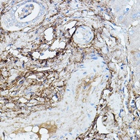 Anti-TGFBI Antibody