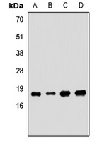 SKP1 Rabbit Polyclonal Antibody