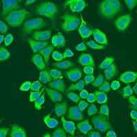 Anti-IGF2BP2 Antibody
