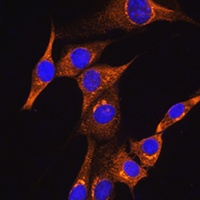 Anti-BDKRB2 Antibody