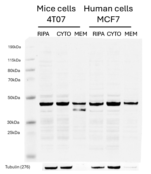 BDKRB2 Rabbit Polyclonal Antibody