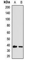HOXA11 Rabbit Polyclonal Antibody