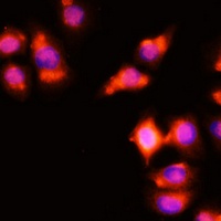 HOXA11 Rabbit Polyclonal Antibody