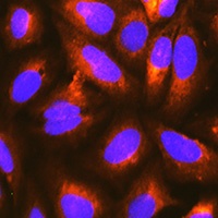 Anti-RAP Antibody