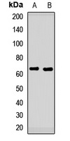 Alpha-internexin Antibody
