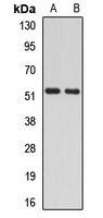 RAD23A Rabbit Polyclonal Antibody