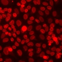 Anti-SETD2 Antibody