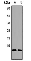 UBC Rabbit Polyclonal Antibody