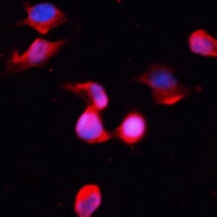CaMK2 gamma Rabbit Polyclonal Antibody
