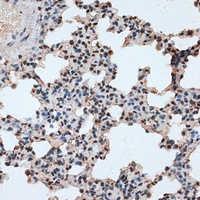Anti-RBM17 Antibody