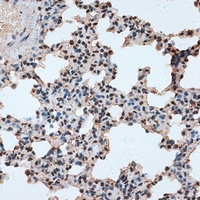 RBM17 antibody