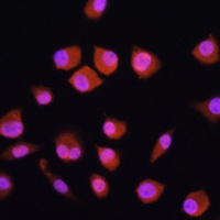 Anti-NPLOC4 Antibody