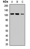 ROR1 Rabbit Polyclonal Antibody