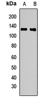 Plasminogen Rabbit Polyclonal Antibody