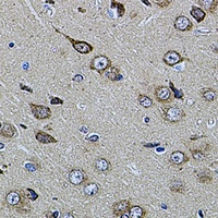 Anti-UQCRC1 Antibody