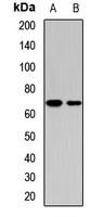 MRPP3 Rabbit Polyclonal Antibody