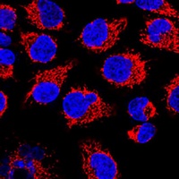 LRP130 Rabbit Polyclonal Antibody