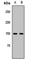 FANCI Rabbit Polyclonal Antibody