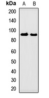 GUCY2D Antibody