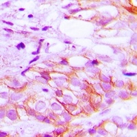Anti-LRP2 Antibody