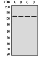 Polycystin 2 Rabbit Polyclonal Antibody