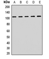 ACTN2 Rabbit Polyclonal Antibody