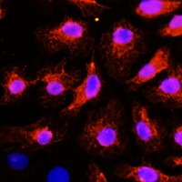 ACTN2 Rabbit Polyclonal Antibody