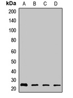 RhoGDI beta Rabbit Polyclonal Antibody