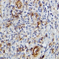 Anti-CD39 Antibody
