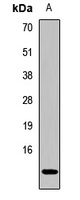 CKS2 Antibody