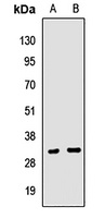 Clathrin Light Chain A Rabbit Polyclonal Antibody