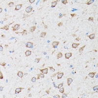 Anti-CYLD Antibody