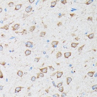 CYLD antibody