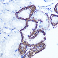 EXTL3 antibody